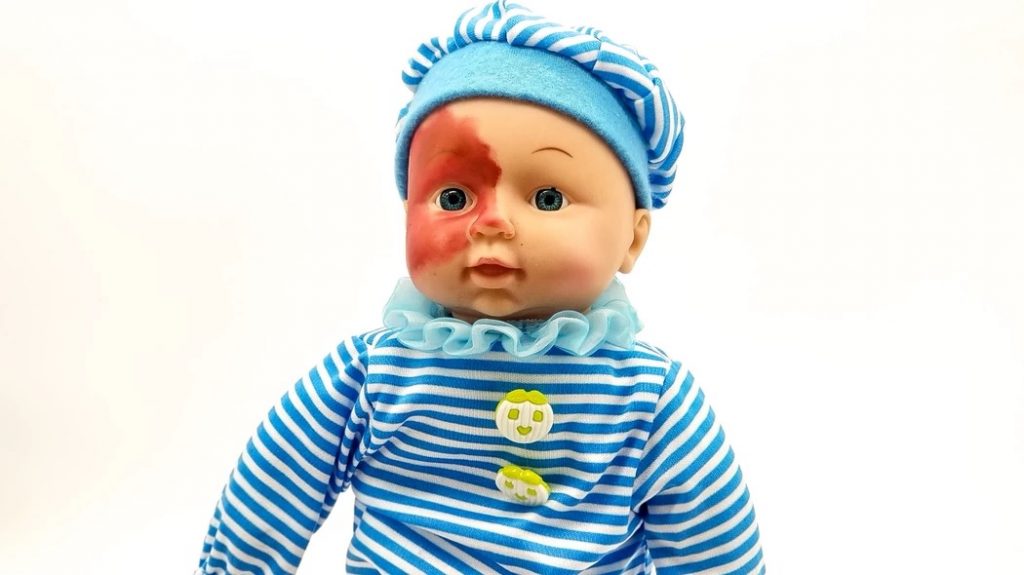 Boneco bebê que tem uma grande mancha vermelha que toma metade do seu rosto.